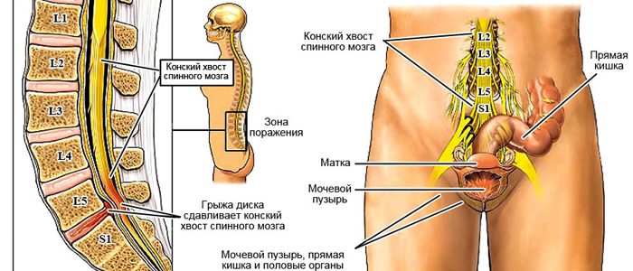 Как быстро похудеть? Правильное питание, питание