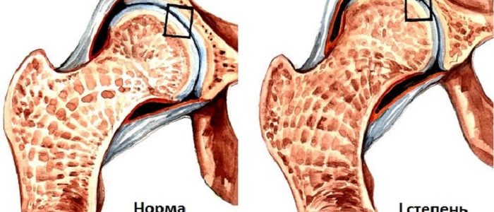 Почему ослабевают процессы восстановления в организме человека